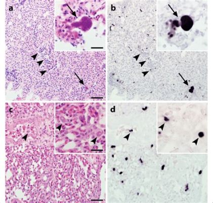  Leucocytozoon! A Tiny Terror With a Talent for Turning Birds Inside Out