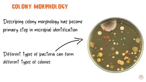  Microciona: Uma Esponja que Faz um Banquete com Bactérias e Vive em Colónias Subaquáticas Misteriosas!